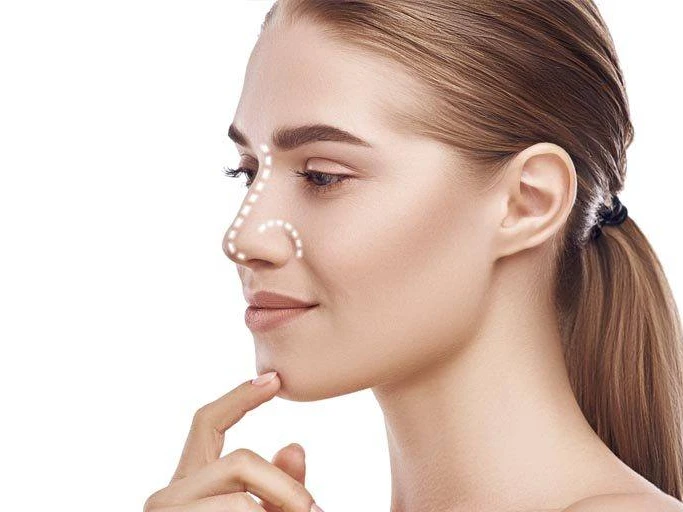 Rinoplastia: ¿Cuándo es el Momento Ideal para Operarse la Nariz?